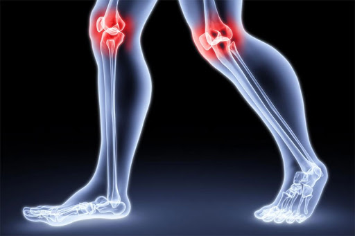 Как при болезнях колена помогут наколенники и где их купить?