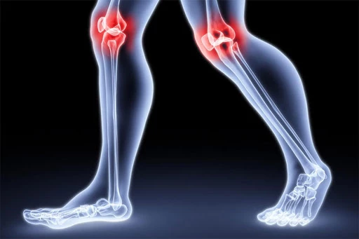 Как при болезнях колена помогут наколенники и где их купить?