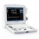 Купить УЗИ аппарат DUS60 с доставкой на дом в интернет-магазине ортопедических товаров и медтехники Ортоп